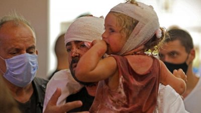 Criana ferida aps exploso na regio porturia de Beirute, em hospital na capital do Lbano Imagem: IBRAHIM AMRO/AFP